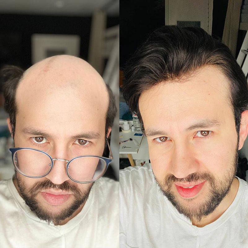 Lace Hair Replacement System