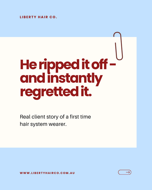 Story of a hair system wearer